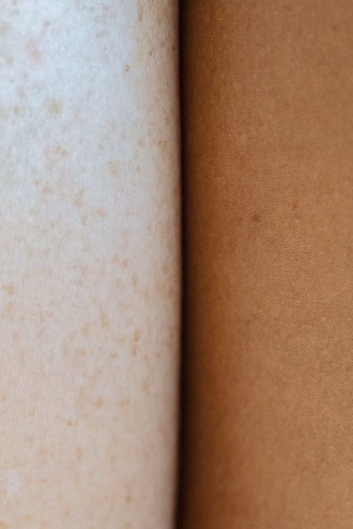 Two skin tones side by side in close-up